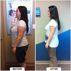 Chiropractic-Westlake-Village-CA-Before-And-After-1-Weight-Loss.jpg