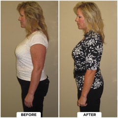 Chiropractic-Westlake-Village-CA-Before-And-After-5-Weight-Loss.jpg