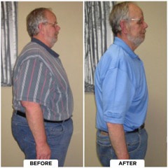 Chiropractic-Westlake-Village-CA-Before-And-After-6-Weight-Loss.jpg